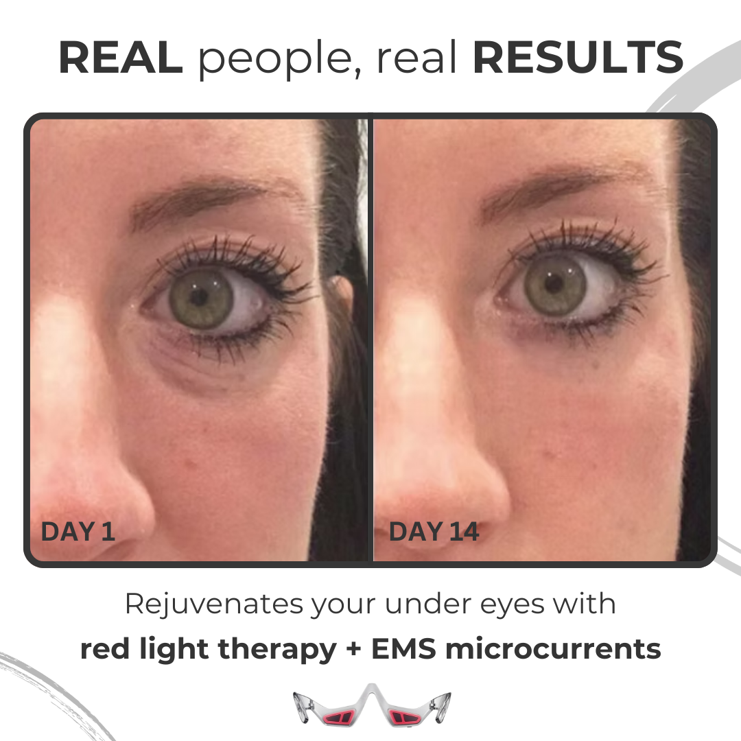 BemelleGlow™ Under Eye Glasses